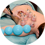 Cupping